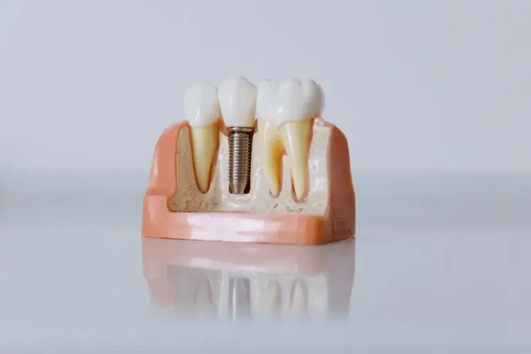 implante dental majadahonda