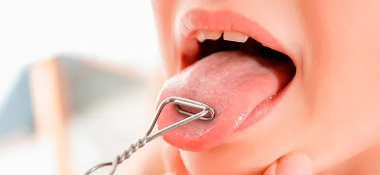 terapia miofuncional