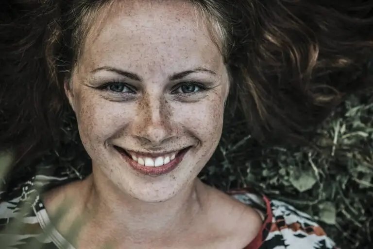 diseno de sonrisa