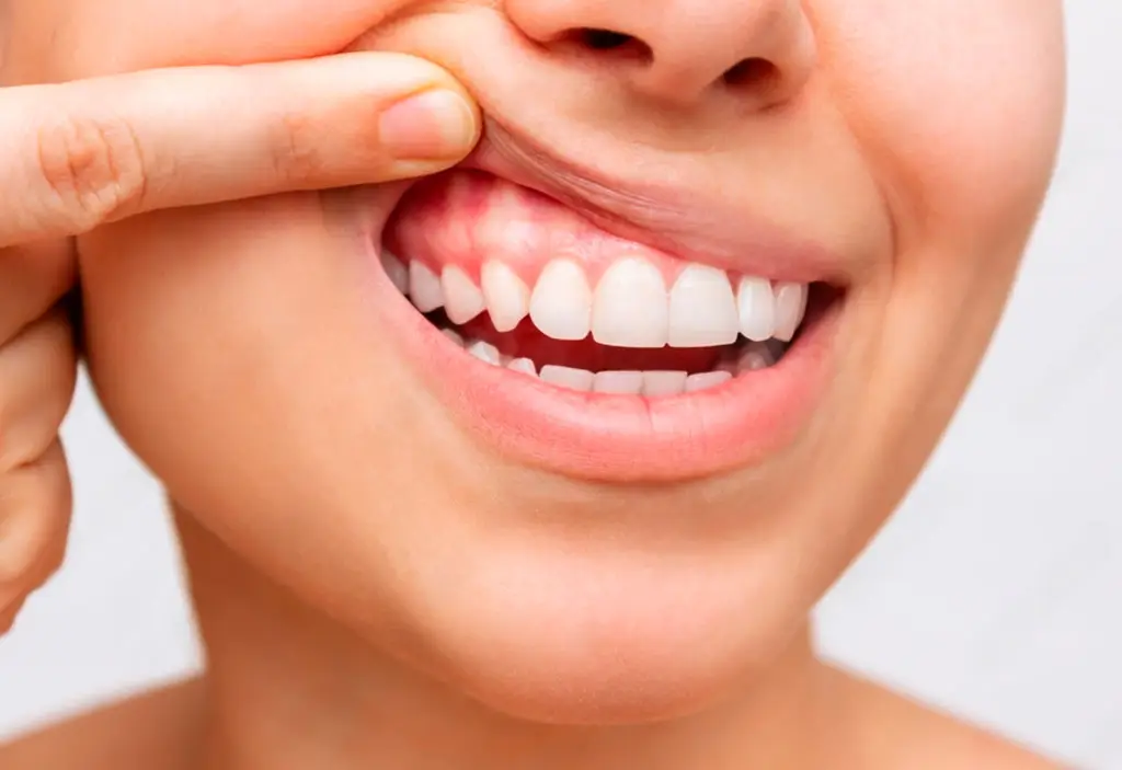 Periodoncia Majadahonda