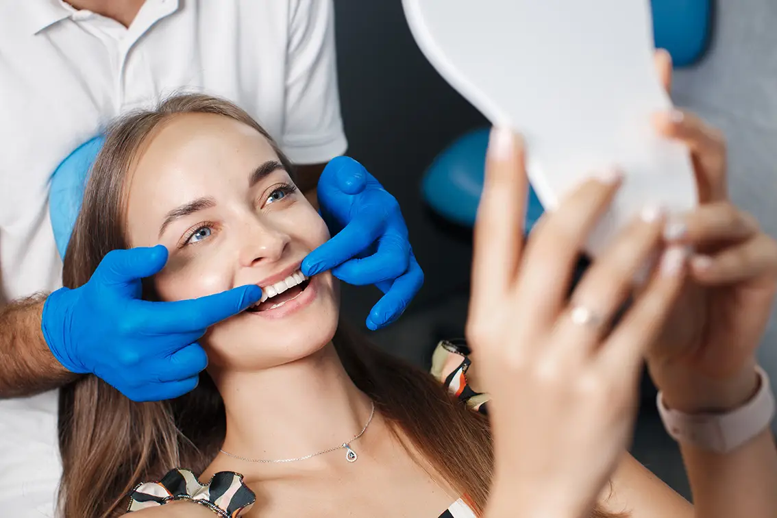 cuando deberías considerar carillas dentales