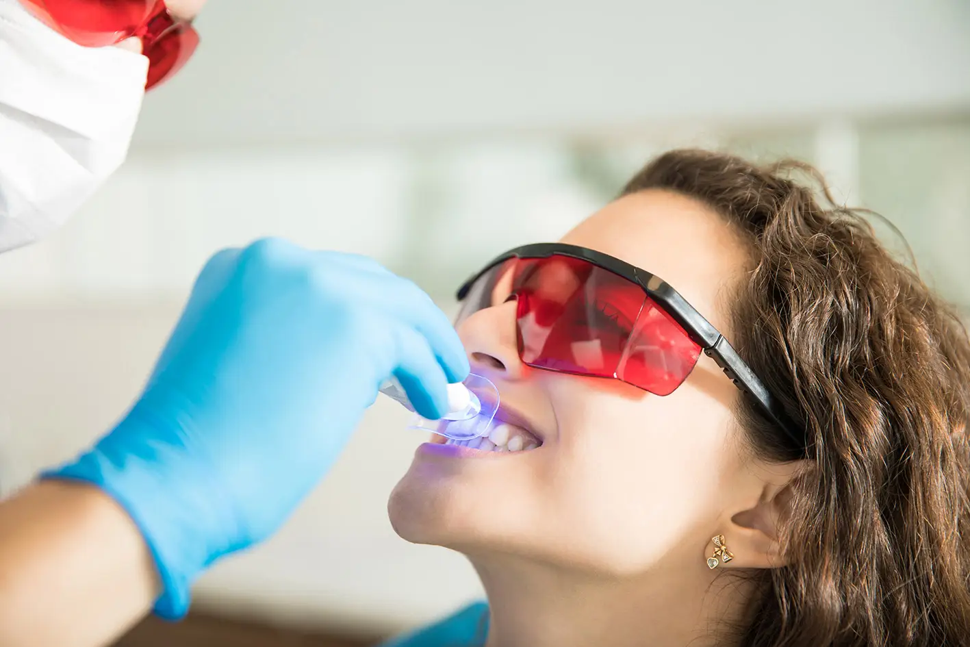 todo lo que necesitas saber blanqueamiento dental
