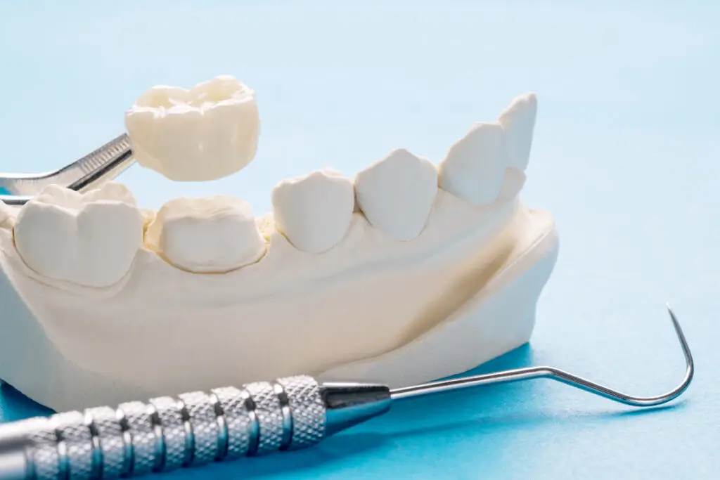 reconstruccion-dental-2