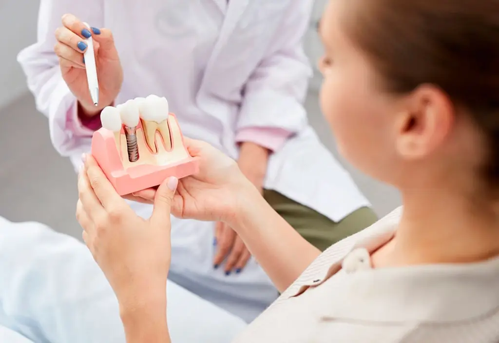implantes dentales