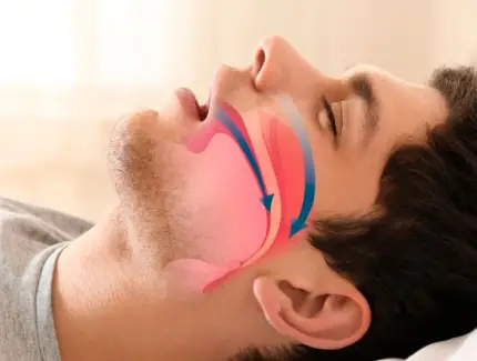 medicina dental del sueno