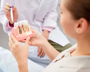implantes dentales
