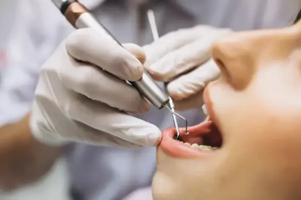endodoncia mejora salud dental