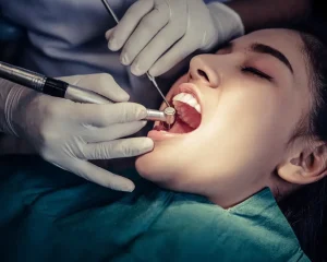 endodoncia tratamiento