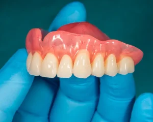 Prótesis Removibles Dentales Majadahonda